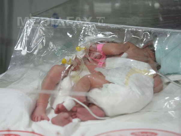 Imaginea articolului O tânără a născut SIAMEZE la Spitalul Judeţean Constanţa. Fetiţele au fost transferate la Spitalul "Marie Curie" din Capitală