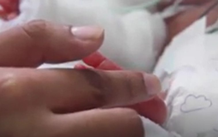 Imaginea articolului VIDEO EMOŢIONANT Nou-născutul de 500 de grame care a scăpat de COVID-19