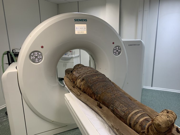 Imaginea articolului GALERIE FOTO | Radiografie şi computer tomograf la o mumie egipteană veche de peste 2.000 de ani. S-a întâmplat la Cluj