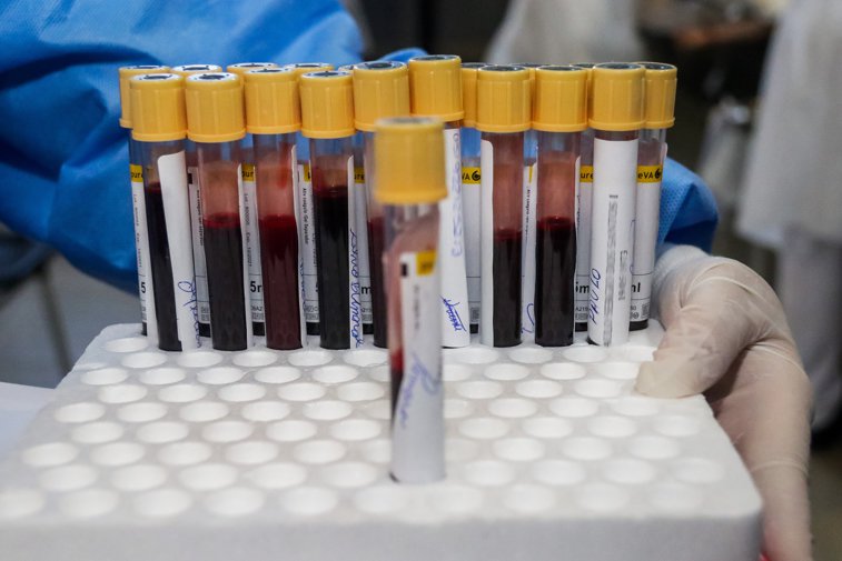 Imaginea articolului Veste bună: Un simplu test de sânge ne-ar putea spune dinainte ce formă de Covid-19 facem. Testul poate fi făcut în orice spital