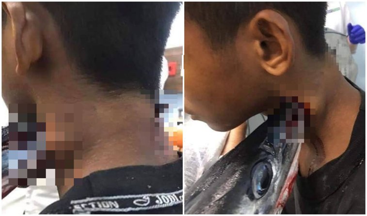 Imaginea articolului Un adolescent a supravieţuit după ce a fost înjunghiat în gât de un zărgan. Cinci medici au fost nevoiţi să îl opereze - FOTO