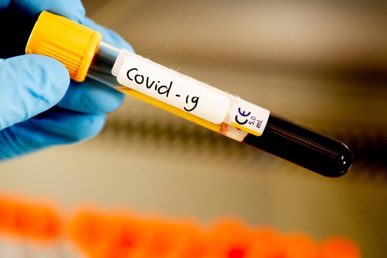 Imaginea articolului Germania: Numărul de cazuri de coronavirus a depăşit 168.500 şi peste 7.000 de decese
