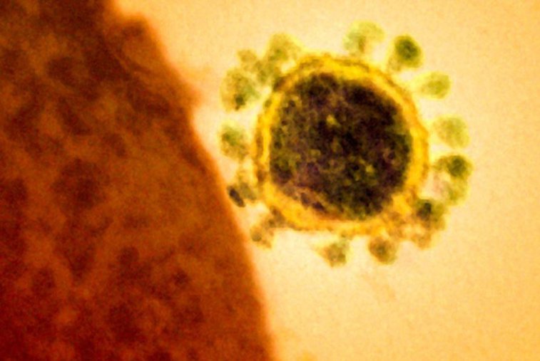Imaginea articolului Oamenii de ştiinţă din Australia au recreat noul tip de coronavirus din China