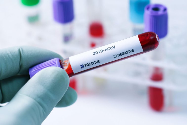 Imaginea articolului Cele 27 de teste pentru coronavirus făcute la „Matei Balş” sunt negative