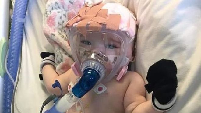 Imaginea articolului Fetiţa de 6 luni, bolnavă de Covid-19, a cărei fotografie de pe patul de spital a făcut înconjurul planetei, s-a vindecat miraculos 