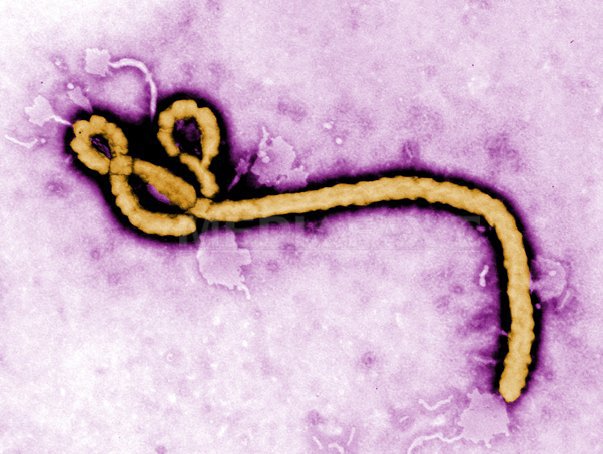 Imaginea articolului AVERTISMENT: Virusul Ebola s-ar putea transmite şi după vindecare, prin contactul cu sperma unui fost bolnav