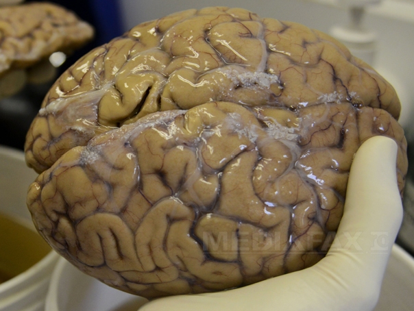Imaginea articolului Cum funcţionează cea mai mare bancă de creier din lume