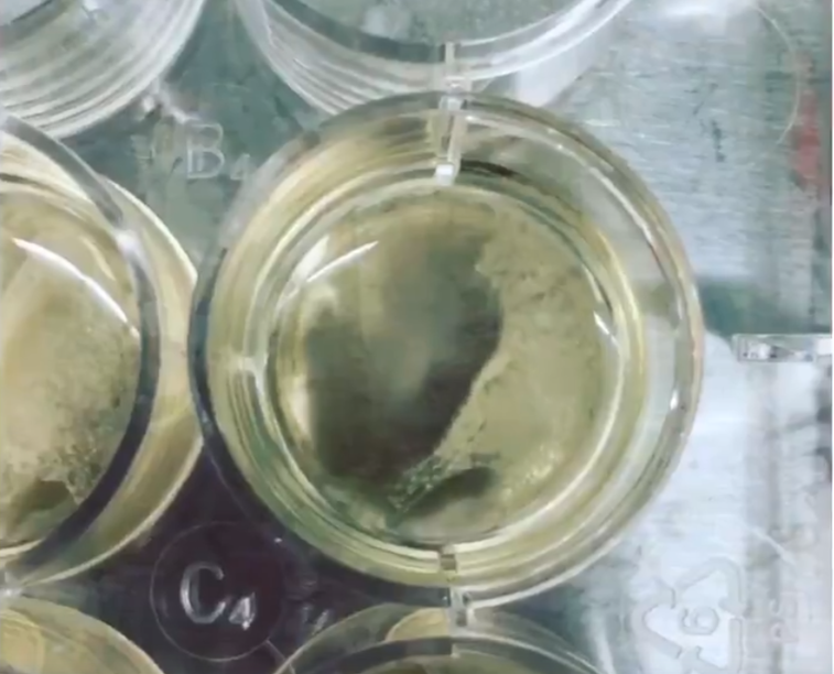 Imaginea articolului Descoperire medicală majoră: Oamenii de ştiinţă au creat o "mini-inimă” care bate într-un vas Petri