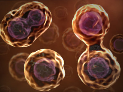 Cancer de prostata co celule mici