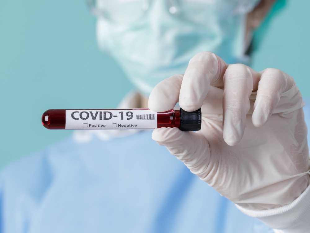 1.075 de noi cazuri de COVID-19 şi 34 de decese în ultimele 24 de ore