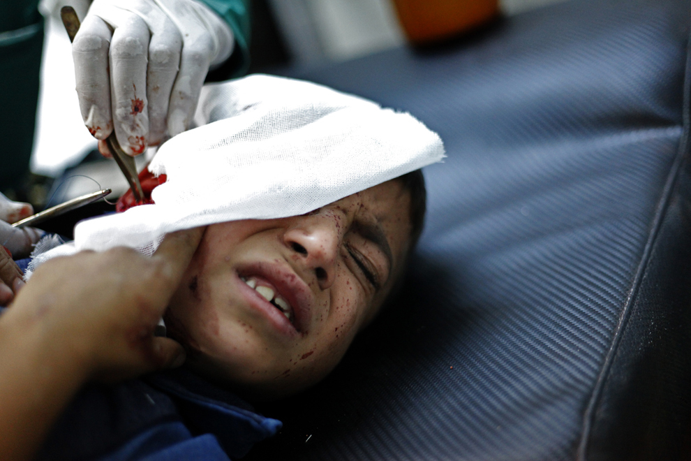 Rănile unui băiat sirian, provocate de un şrapnel, sunt tratate într-o mică clinică din Alep, miercuri, 31 octombrie 2012. (Javier Manzano / AFP)