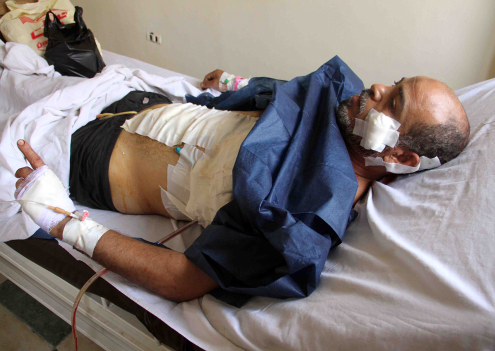 Un suporter rănit al preşedintelui Mohamed Morsi, stă pe un pat de spital, în Cairo, Egipt, miercuri, 3 iulie 2013. 