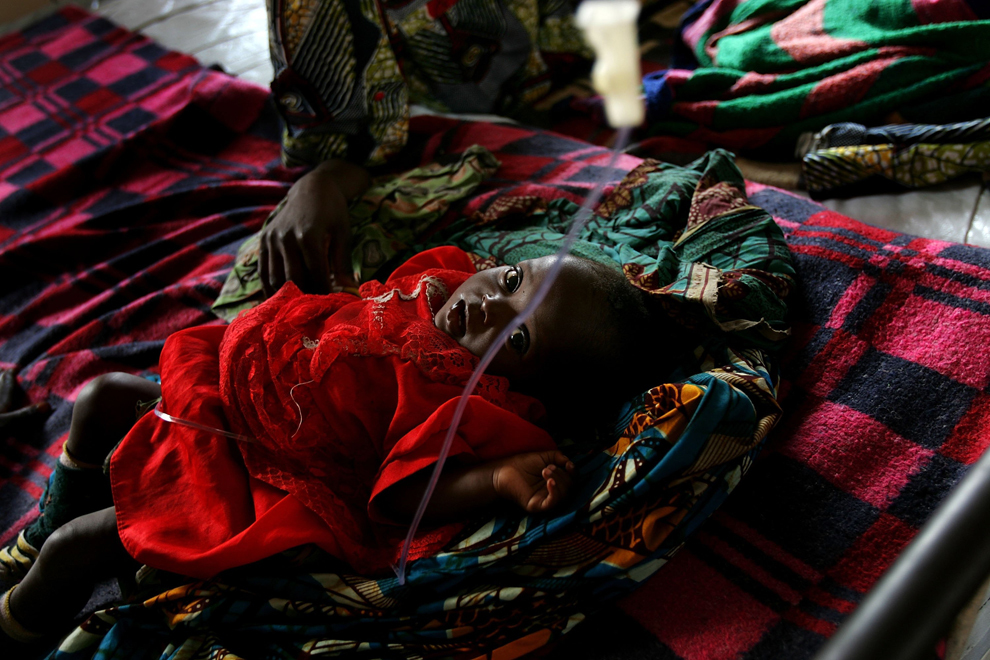 Un copil ce suferă de malarie stă pe un pat dintr-un spital din Rutchuru, Republica Democrată Congo, vineri, 10 martie 2006.