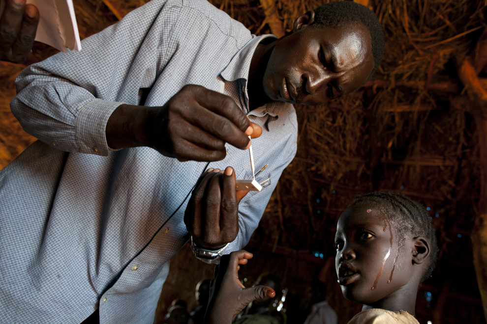 O fetită ce suferă de febră este testată pentru malarie, la clinica medicala CARE din tabara de refugiaţi Yida, în Sudanul de Sud, joi, 5 iulie 2012.