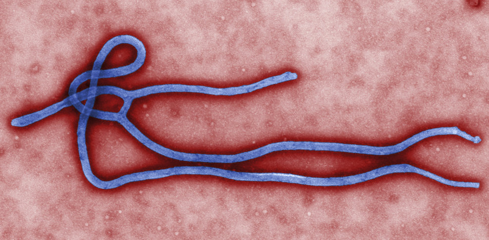 Imagine microscopică (TEM) cu modificările virusului Ebola lansată de Centrul pentru Controlul Bolilor (CDC) din Atlanta, Georgia, marţi, 24 marţie 2014.