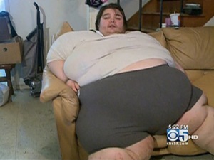 Metode slabit obezi
