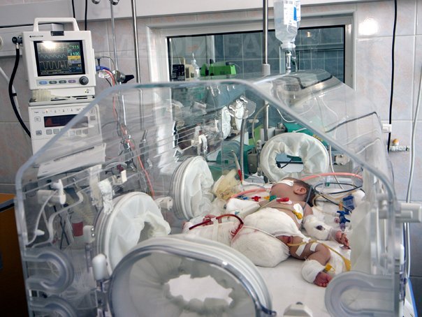 Imaginea articolului Caz de subnutriţie în Motru: Un bebeluş de şase săptămâni care cântărea doar două kilograme, dus la spital