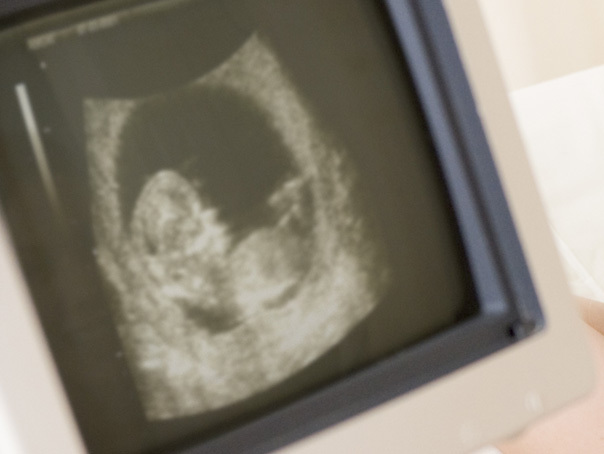 Imaginea articolului România are cea mai ridicată rată de avort din Europa: 480 de avorturi la 1.000 de naşteri