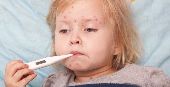 Imaginea articolului Listă scurtă de măsuri pentru epidemia de rujeolă, decisă de două ministere. 180.000 de copii sunt nevaccinaţi, doar pentru 10% se refuză vaccinarea, restul nu ajung la medicul de familie