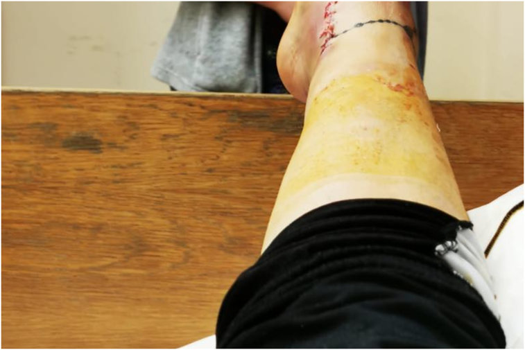 Imaginea articolului Medic, către o rănită în accident: Ce dracu' porţi sutien, dacă tu ai silicoane?