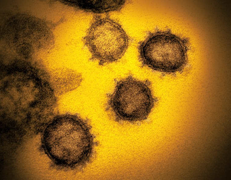 Imaginea articolului Încă o tulpină de coronavirus depistată