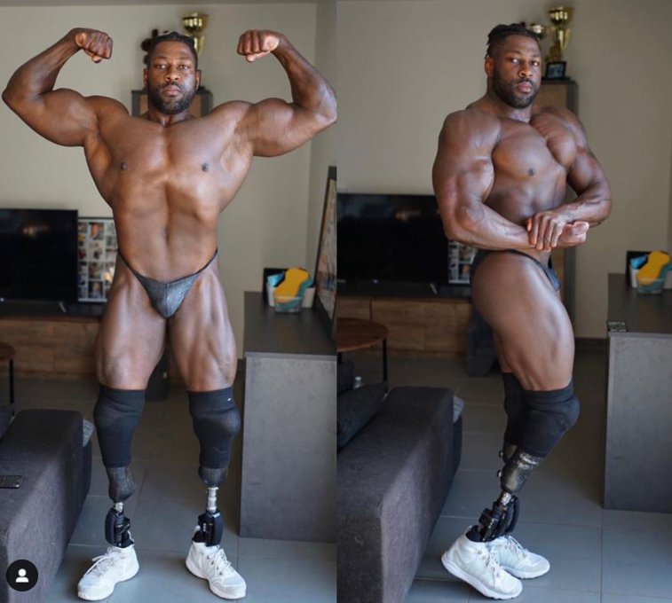 Imaginea articolului Campionul bionic. Are picioarele amputate, dar asta nu l-a oprit