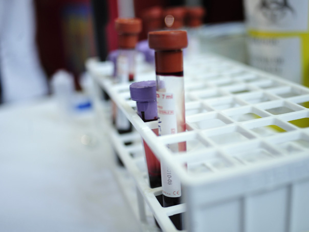 Imaginea articolului Cercetătorii germani au dezvoltat primul test pentru diagnosticarea virusului depistat în China