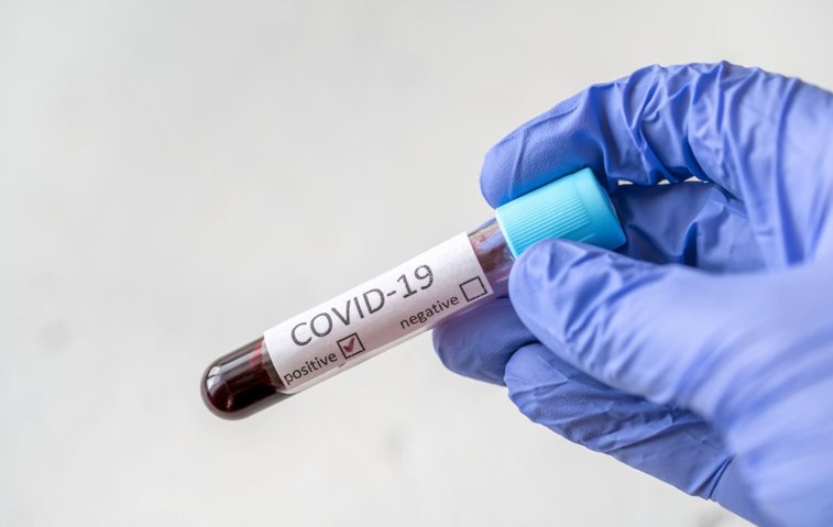 Imaginea articolului Primul test care îţi arată cât de imun eşti la coronavirus a fost creat în Franţa