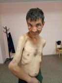 Imaginea articolului Mikhailo Dianov, luptător la Azovstal, a rămas doar piele şi os, la capătul a 4 luni de captivitate în mâinile Rusiei

