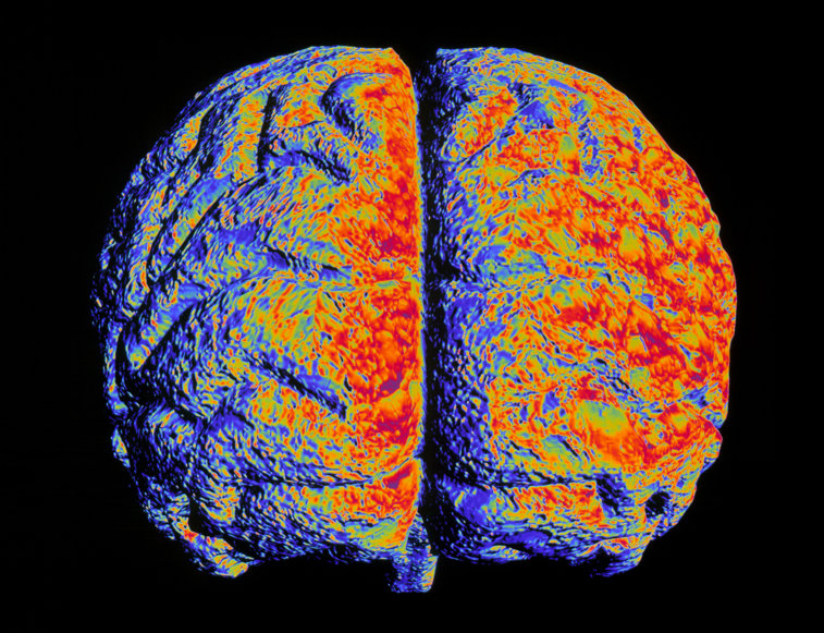 Imaginea articolului În câţiva ani, boala Alzheimer va putea fi depistată printr-un test de sânge