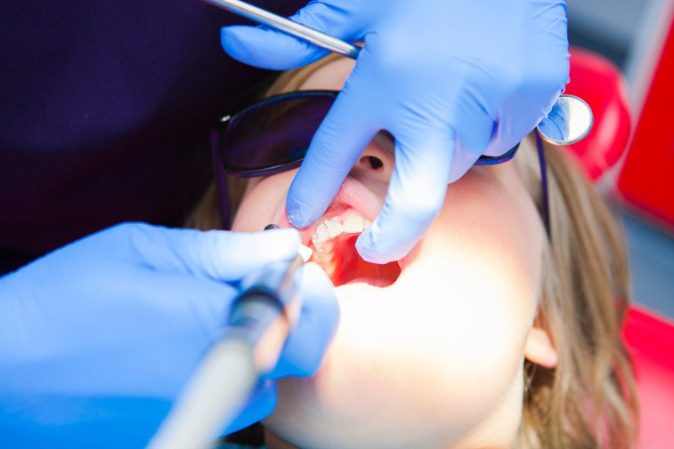 Imaginea articolului Igiena dentară este problematică în România. Doar 37% dintre aduţi se spală zilnic pe dinţi, iar 48,7% folosesc guma de mestecat