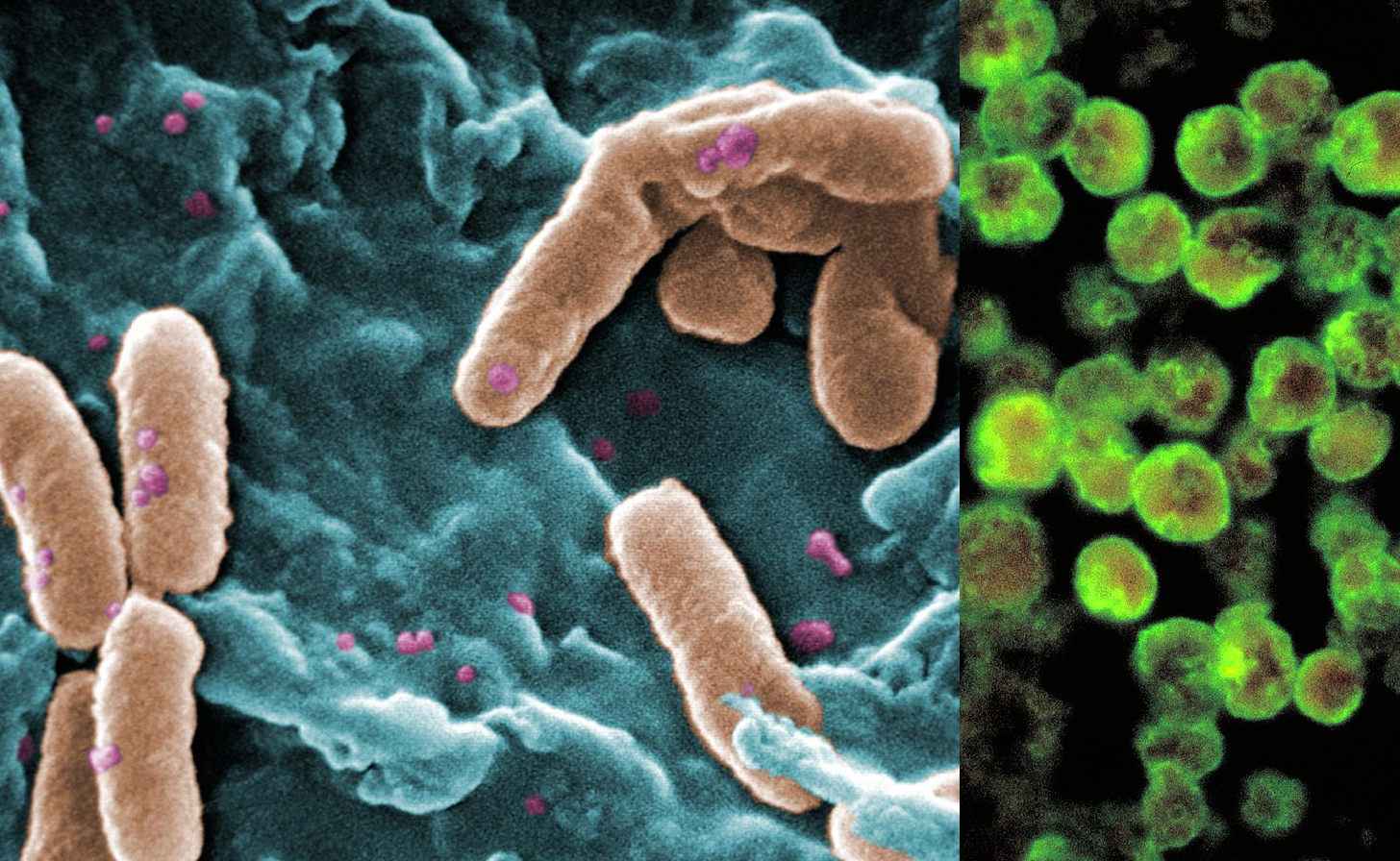 Superbacteriile rezistente la antibiotice ar putea ucide mai mulţi oameni decât pandemia