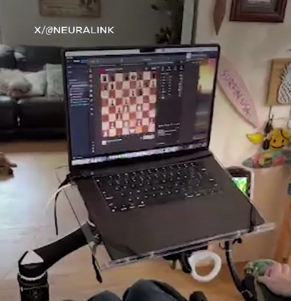 Imaginea articolului Primul pacient cu cip cerebral joacă şah online
