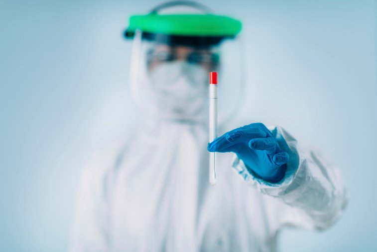 Imaginea articolului Oamenii de ştiinţă anunţă un nou test pentru detectarea imunităţii la coronavirus