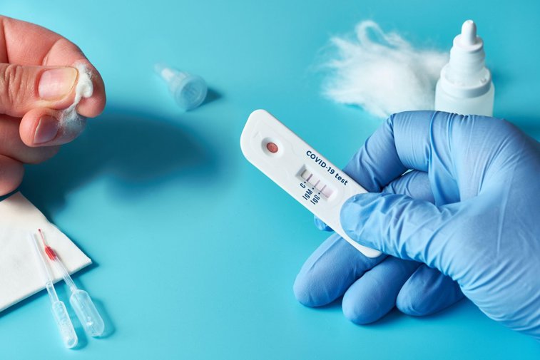 Imaginea articolului Testarea anticorpilor după vaccinare a intrat pe lista jucătorilor din piaţa medicală privată. Care sunt preţurile
