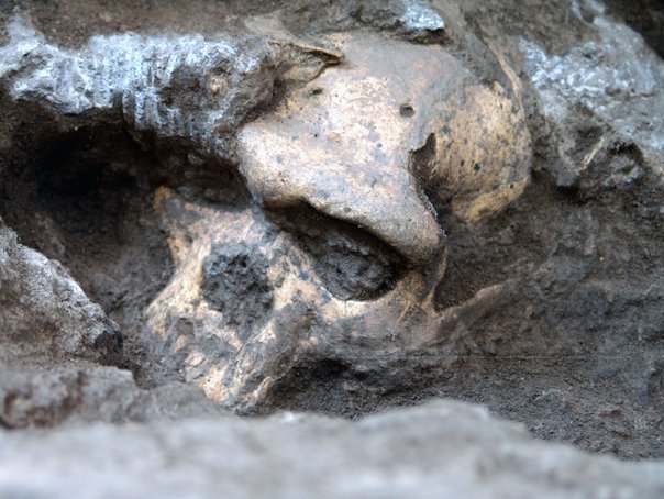 Imaginea articolului A fost descoperit craniul unei femei, ce avea o formă bizară - FOTO