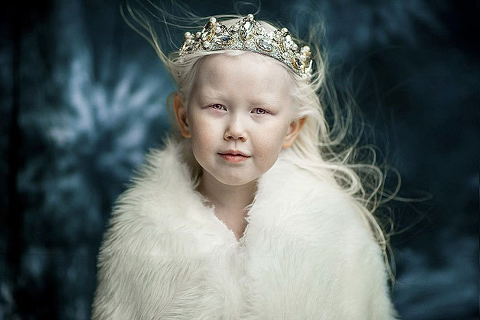 Imaginea articolului GALERIE FOTO Nariyana, fetiţa cu albinism a cărei frumuseţe întrece orice imaginaţie. Agenţiile de modelling o copleşesc cu oferte 