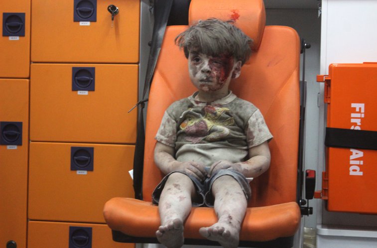 Imaginea articolului FOTO, VIDEO | Omran Daqneesh, băieţelul devenit simbol al tragediei umanitare din Siria, fotografiat din nou. Cum arată acum, după un an de la atacul din Alep