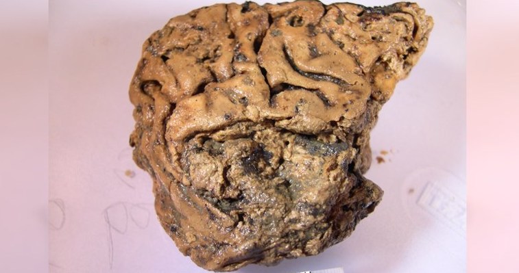 Imaginea articolului Un creier uman „a supravieţuit” 2.600 de ani într-un craniu. Explicaţia oamenilor de ştiinţă