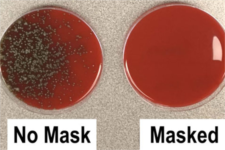 Imaginea articolului Cât de bine te protejează masca? Un cercetător a făcut o demonstraţie simplă, pe înţelesul tuturor. FOTO&VIDEO