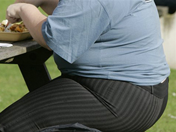 Imaginea articolului Cercetătorii au descoperit o genă care creşte riscul de obezitate