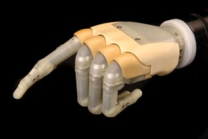 Imaginea articolului World’s First Bionic Hand Makes It To Romanian Market