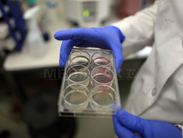 Imaginea articolului Specii noi de bacterii cu proprietăţi depoluante, izolate de cercetători din Miercurea Ciuc - FOTO