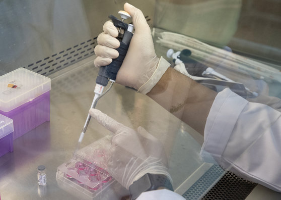 Imaginea articolului Vaccinul împotriva Ebola. Cercetătorii de la Universitatea Oxford derulează studii clinice