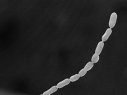 Imaginea articolului Bacteria gigantică vizibilă cu ochiul liber: atinge 2 centimetri, de 5.000 de ori mai mult decât alte bacterii