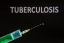 Imaginea articolului Ziua Mondială de Luptă împotriva Tuberculozei: În România sunt aproximativ 30.000 de bolnavi