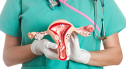 Imaginea articolului Histerectomie - ce pot păţi femeile dacă şi-au îndepărtat uterul pe cale chirurgicală 