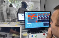 REPORTAJ MEDICAL. Bine aţi venit în viitor! Cum scot neurochirurgii bisturiul din sala de operaţie printr-o tehnologie inovatoare folosită pentru tremorul mâinilor